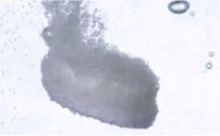 Les méfaits méconnus du paracétamol 